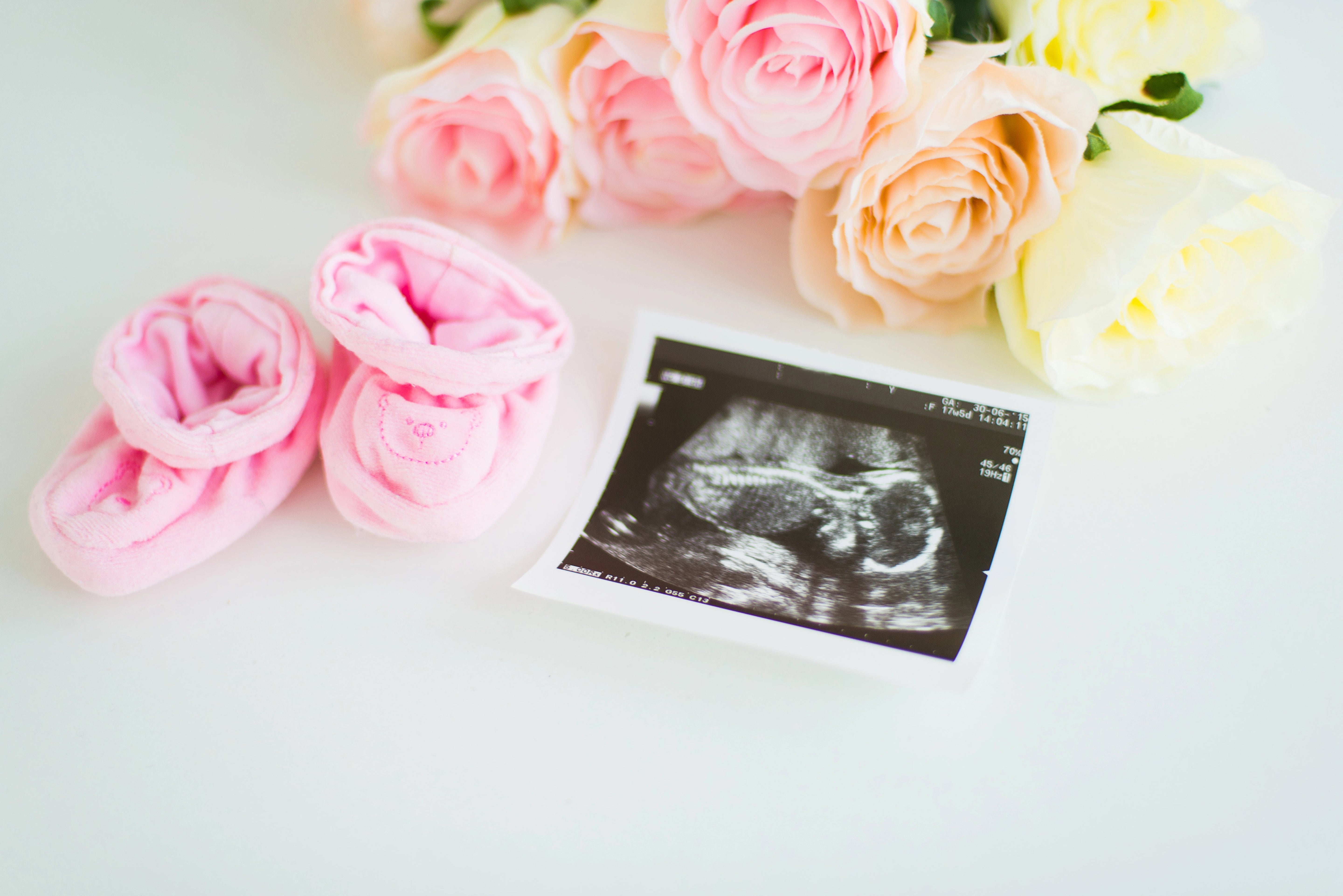 Ultrasound image of a baby on awhite table surrounded by flowers and baby booties